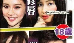 成都整容爆料案件最新,揭开医美行业潜规则与维权困境